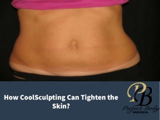 How CoolSculpting Can Tighten the Skin?