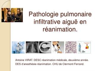 Pathologie pulmonaire infiltrative aiguë en réanimation.