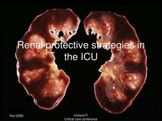Renal protective strategies in the ICU