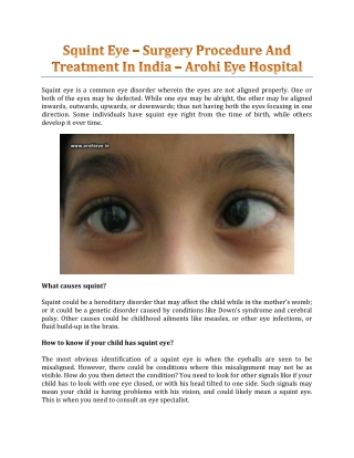 Squint Eye – Surgery Procedure And Treatment In India - Arohi Eye Hospital
