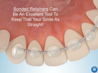 Pros and Cons of Bonded Retainers | Orthodontic Experts