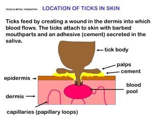 TICKS &amp; MITES / PARASITES LOCATION OF TICKS IN SKIN