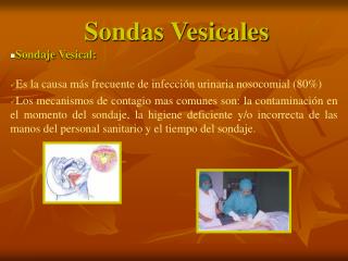 Sondas Vesicales