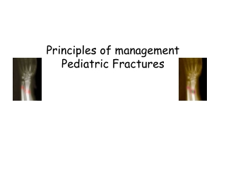 Principles of management Pediatric Fractures