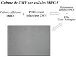 Culture de CMV sur cellules MRC-5