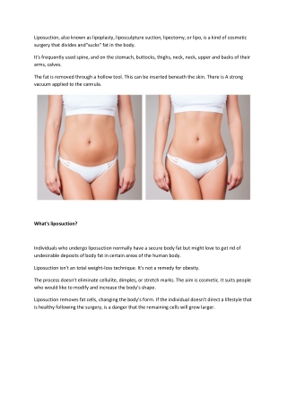 Benefits and Outcomes of Liposuction Surgery