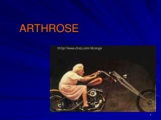 ARTHROSE