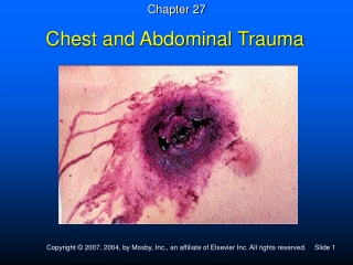 Chest and Abdominal Trauma