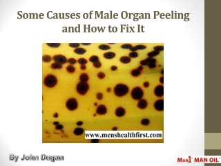 Some Causes of Male Organ Peeling and How to Fix It