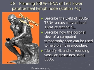 #8. Planning EBUS-TBNA of Left lower paratracheal lymph node (station 4L)