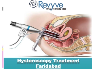 Hysteroscopy Treatment Faridabad
