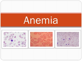 Anemia