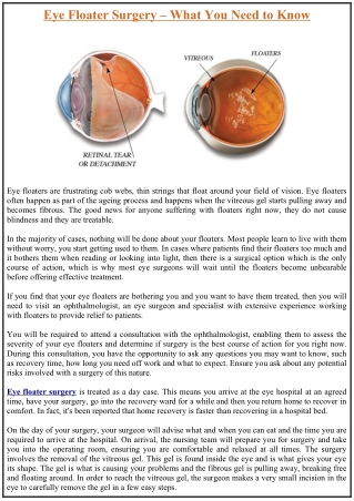 Eye Floater Surgery – What You Need to Know