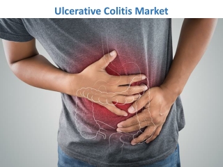 Ulcerative Colitis Market Expected to Reach $4,785 Million by 2023