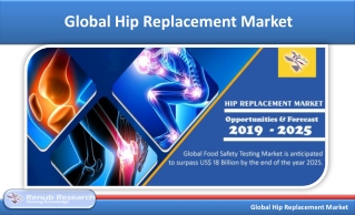 Global Hip Replacement Market is US$ 7 Billion by 2025