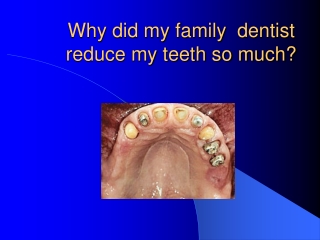 Why did my family dentist reduce my teeth so much?