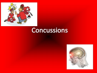 Concussions