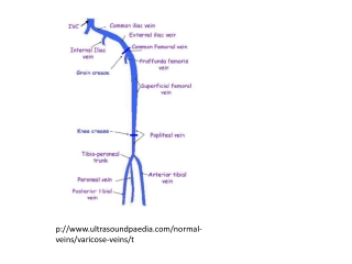 p :// ultrasoundpaedia /normal -veins/varicose -veins /t