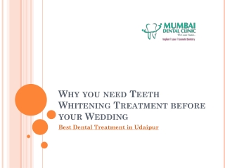 Why you need Teeth Whitening Treatment before your Wedding