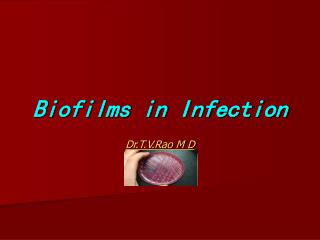 Biofilms