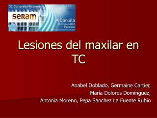 Lesiones del maxilar en TC