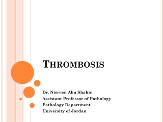 Thrombosis