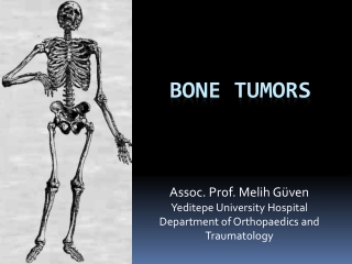 BONE TUMORS