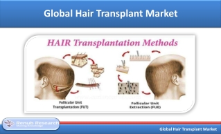 Hair Transplant Market - Global Industry Trends, Forecast 2019-2025