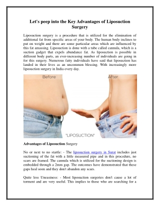 Let's peep into the Key Advantages of Liposuction Surgery
