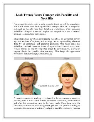 Look Twenty Years Younger with Facelifts and Neck lifts