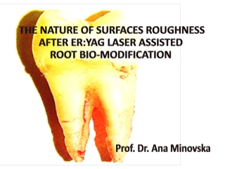 THE NATURE OF SURFACES ROUGHNESS AFTER ER:YAG LASER ASSISTED ROOT BIO-MODIFICATION