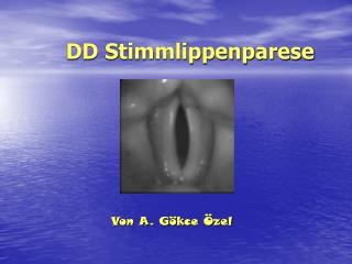 DD Stimmlippenparese