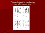 Kvinnelig genital mutilering bilde Comfort Momoh s hefte