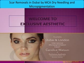 Scar Removals in Dubai by MCA Dry Needling and Micropigmentation