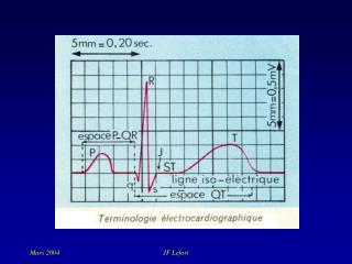 Électrocardiogramme ECG (8)