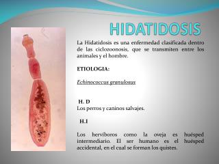 HIDATIDOSIS