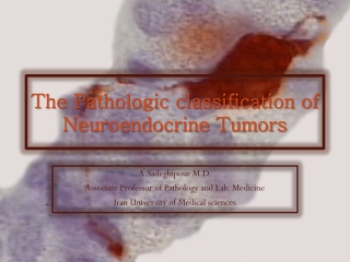 The Pathologic classification of Neuroendocrine Tumors