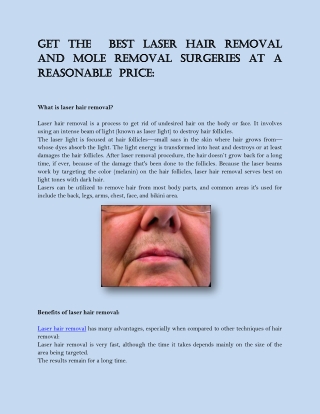 Get the best laser hair removal and Laser mole removal surgeries at a reasonable price