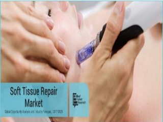 Soft Tissue Repair Market Rising at a CAGR of 5.6% from 2017-2025