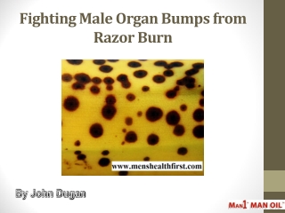 Fighting Male Organ Bumps from Razor Burn