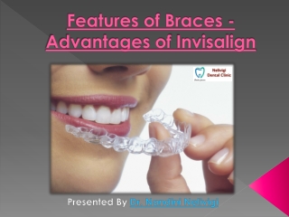 Features of Braces - Advantages of Invisalign | Invisalign Treatment in Bangalore