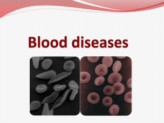 Blood diseases