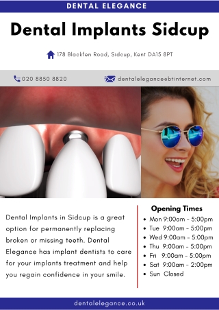 Dental Implants Sidcup