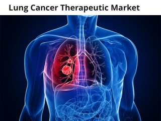 Lung Cancer Therapeutic Market