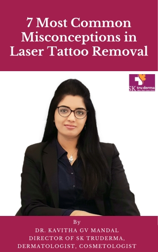 7 Most Common Misconceptions in Laser Tattoo Removal