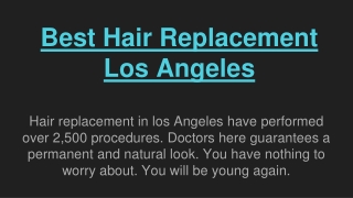 Best Hair Replacement Los in Angeles