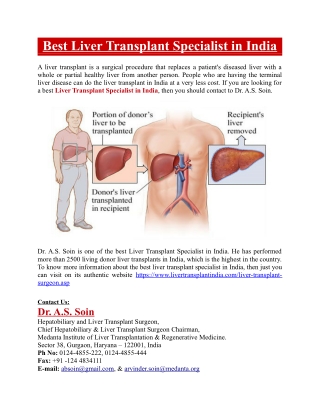 Best Liver Transplant Specialist in India