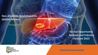 Non-Alcoholic Steatohepatitis (NASH) Market By Size, Status And Forecast 2025