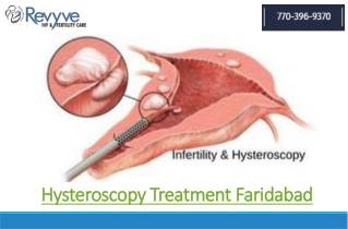 Hysteroscopy Treatment Faridabad