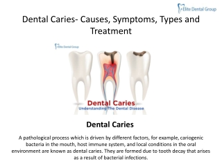 Dental Caries- Causes, Symptoms, Types and Treatment